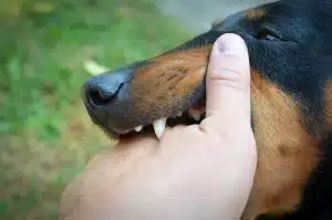 Dog bite injury
