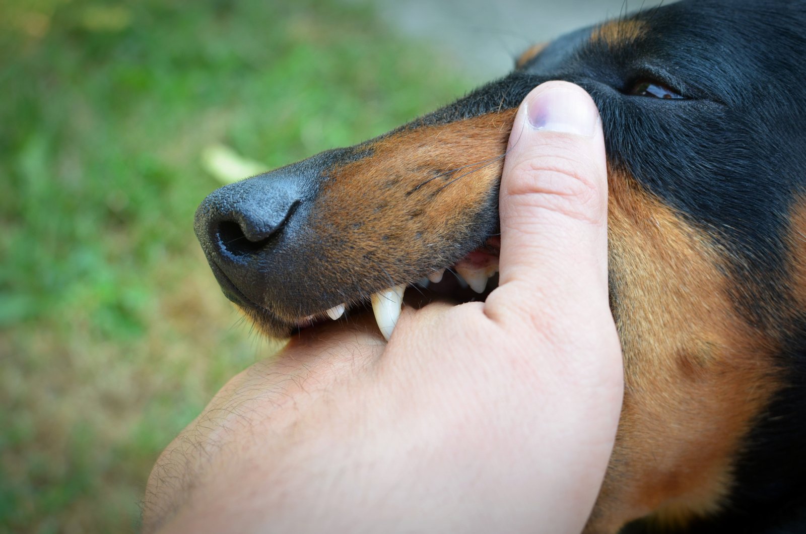 Dog bite injury